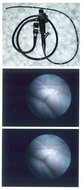 Olympus Gif-xp20 Pediatric Gastroscope