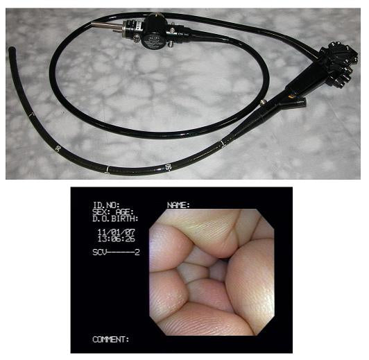 Olympus Cf-100s Video Sigmoidoscope,