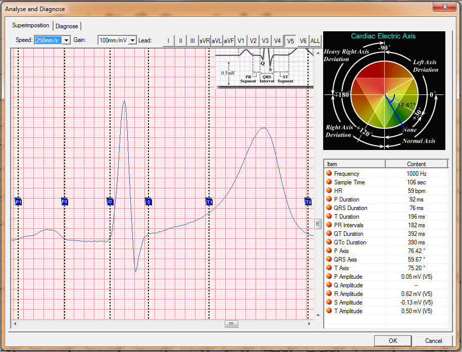 (New) Whittemore Enterprises Digital Touch Screen 12-channel 12-lead ECG EKG