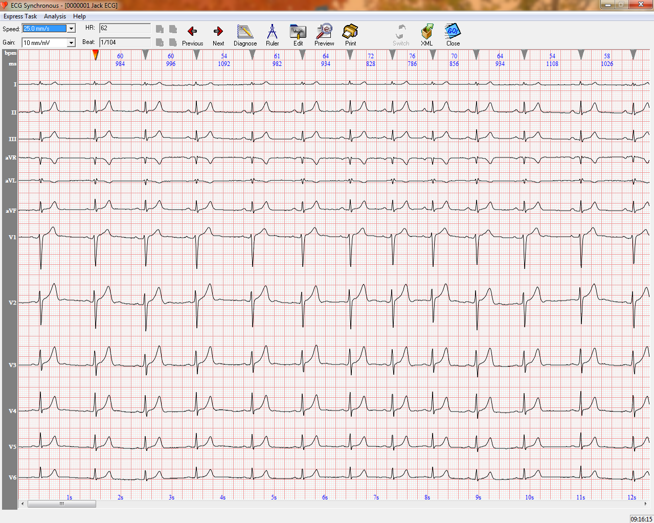 (New) Whittemore Enterprises Digital Touch Screen 12-channel 12-lead ECG EKG