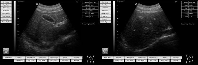 New Whittemore Portable Laptop Ultrasound 10.1" LCD