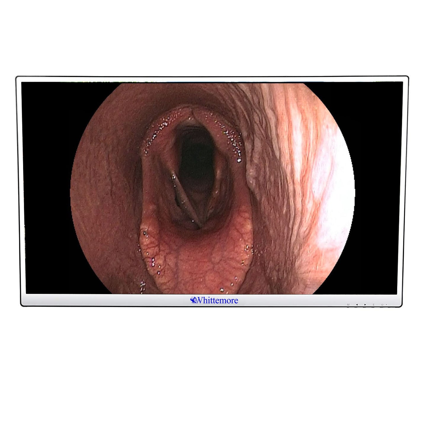 New Whittemore H.D LED 32" Monitor