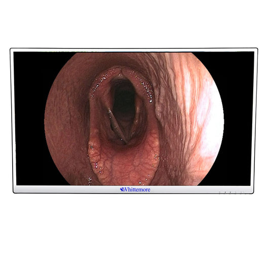 New Whittemore H.D LED 32" Monitor