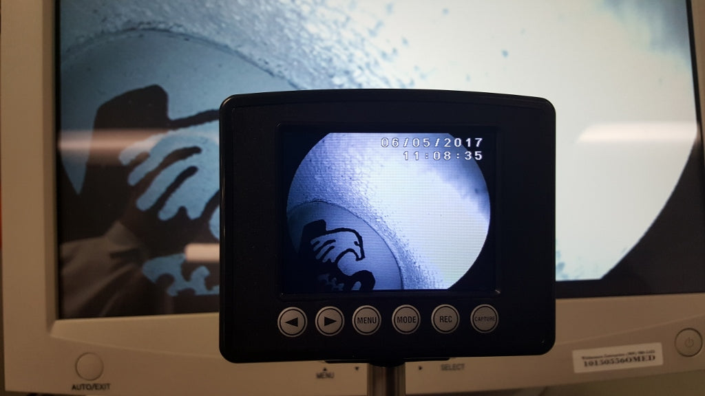 NEW WHITTEMORE MP4 VIDEO CAPTURE LCD MONITOR FOR FLEXIBLE VIDEOSCOPES