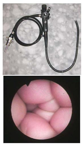 Olympus Flexible Sigmoidoscope