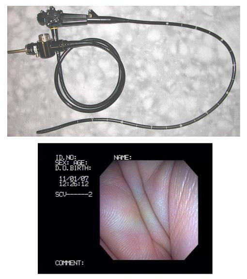 Olympus Jf-100 Video Duodenoscope