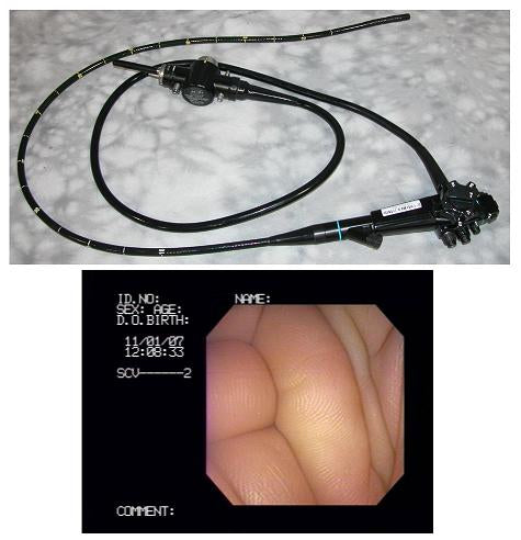 Olympus Jf-130  Video Duodenoscope