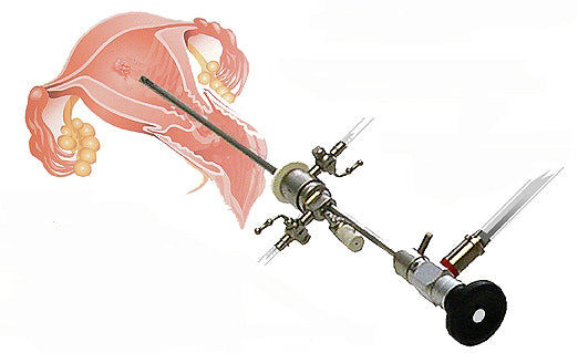 Storz Bettocchi Type OFFICE HYSTEROSCOPY Set New