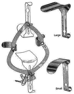 O'Sullivan-O'Connor Abdominal Retractor
