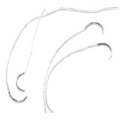 Dyonics Ultrabraid Suture And Needle