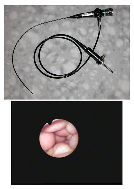 OLYMPUS BF3C10 PEDIATRIC BRONCHOSCOPE