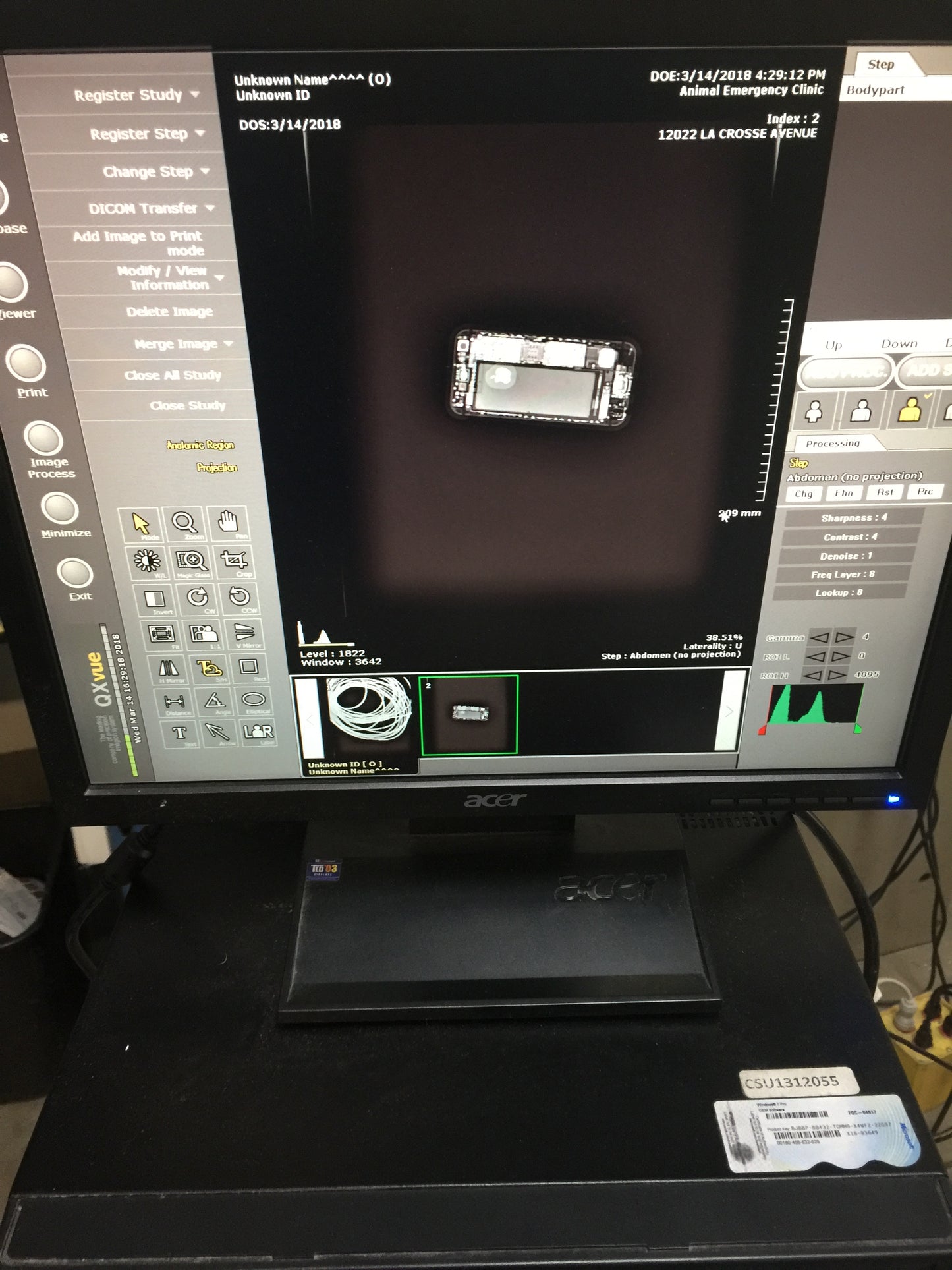 Veterinary X-Ray High Frequency With QXLINK- DIGITAL DETECTOR