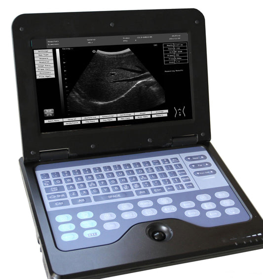 New Whittemore Portable Laptop Ultrasound 10.1" LCD