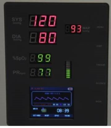 WE VITAL SIGNS MONITOR